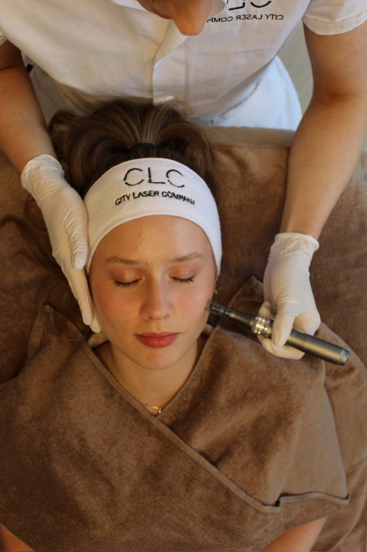 CLC Microneedling